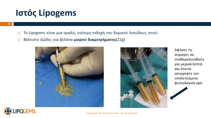 Ιστός LIPOGEMS