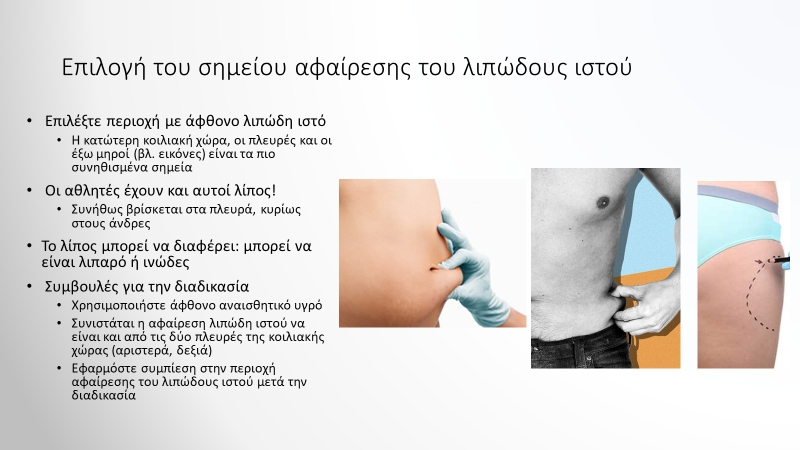 Επιλογή του σημείου αφαίρεσης του λιπώδους ιστού