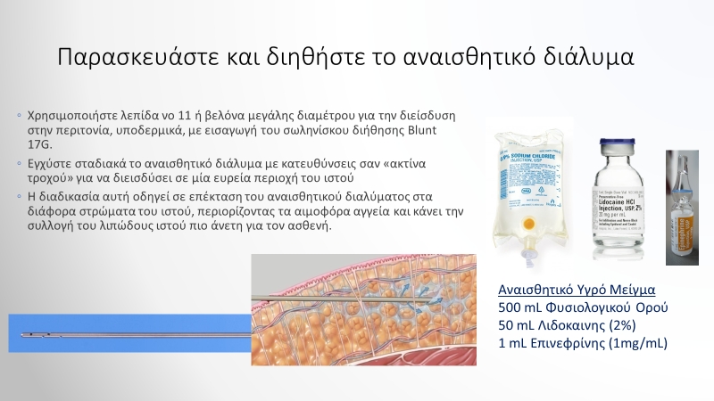 Παρασκευάστε και διηθήστε το αναισθητικό διάλυμα