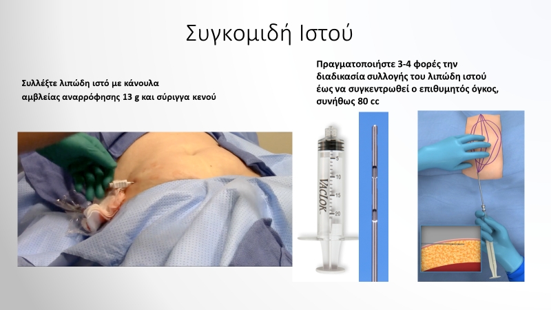 Συγκομιδή Ιστού