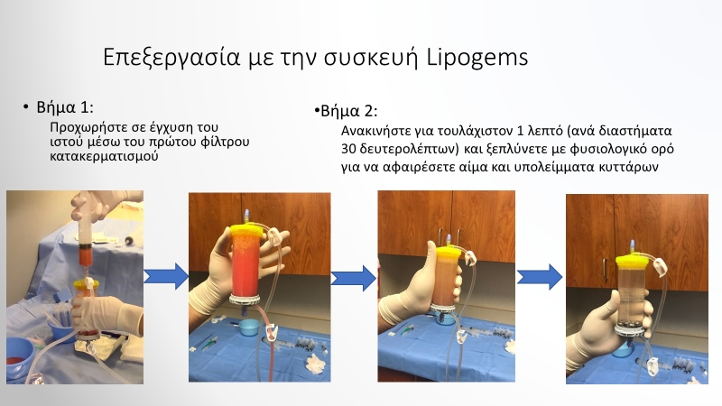 Βήμα 1 & 2