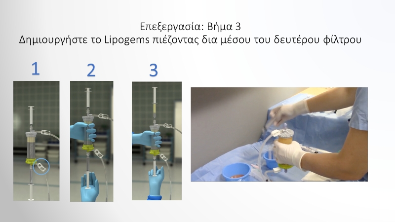 Βήμα 3